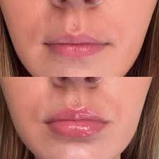 🎉 Happy 9th December, beauties! 🎉 Can you believe we're just two weeks  away from Christmas Eve Eve?! 🎅🏼🎄 The festive countdown is officially ON  — and it's time to sparkle, shine,