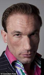 Masturbation and hair loss are two subjects that we seem to discuss intently, yet poorly understand. Embarrassing Bodies Dr Christian Jessen Has Wayne Rooney Hair Implants After Twitter Mocks Bald Patch Daily Mail Online
