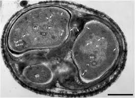 Check spelling or type a new query. De Novo Organelle Biogenesis In The Cyanobacterium Tdx16 Released From The Green Alga Haematococcus Pluvialis Biorxiv