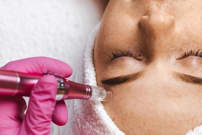 Derma roller being used on the cheek