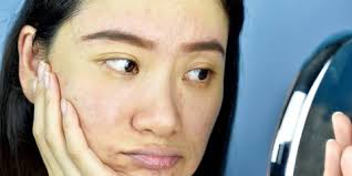 Banyak orang mencerahkan dan memutihkan kulit dengan cara memanfaatkan asam kojic. 16 Cara Mencerahkan Wajah Kusam Secara Alami
