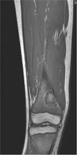 Abstract - 2024 - Journal of Hospital Medicine - Wiley Online Library