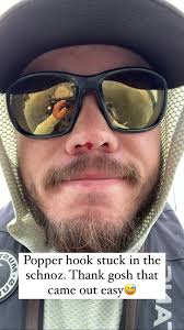 This was an interesting one today, glad it wasn’t worse and glad I had