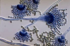 Image result for aspergillus