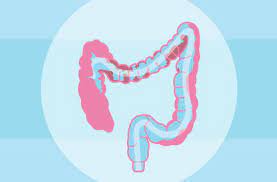 What can i expect from a colon cleanse? 4 Things You Should Know About Colon Cleansing Health Essentials From Cleveland Clinic