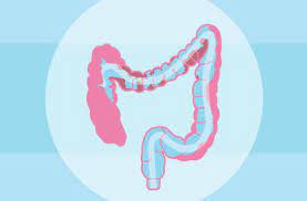 The practice of natural colon cleansing , or colonic irrigation, dates back to ancient greece. 4 Things You Should Know About Colon Cleansing Health Essentials From Cleveland Clinic