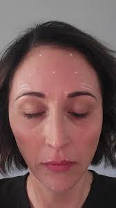 @nursejess_derma giving me all the #dysport vibes today ❤️