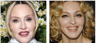 When did the gap disappear? Is the new smile a clip-in grill? Without the  gap, is she still "The Queen?"