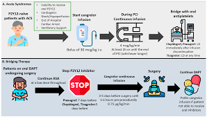 Image result for Cangrelor