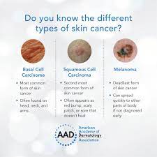Basal cell carcinoma (bcc) and squamous cell carcinoma (scc). American Academy Of Dermatology Each Type Of Skin Cancer Can Display On Your Skin Differently Learn About The Different Types Of Skin Cancer Https Bit Ly 2sxlbxb Facebook