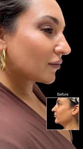 Manhattan Plastic Surgery & Aesthetic Care