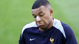 Ngôi sao tuyển Pháp lộ diện với chiếc mặt nạ chuẩn "Ninja Rùa" sau khi nhập  viện vì gãy mũi