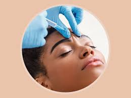 Botox Freezes My Forehead — & My Anxiety Levels