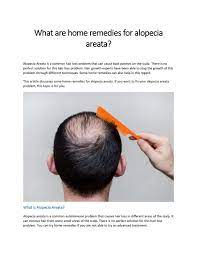 A natural solution to hair loss there are a plethora of. What Are Home Remedies For Alopecia Areata By Daniela Doll Issuu