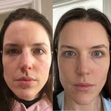 Rejuvenating and Anti-Aging Collagen Face Moisturizer with Stem Cells