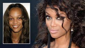 Despite the divorce of her parents when she was only six years old. Tyra Banks Gute Gene Oder Guter Arzt Bunte De