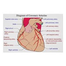 They are the first artery to branch off from the aorta and is are some of the largest arteries in the body. Diagram Of The Coronary Arteries Of A Human Heart Poster Coronary Arteries Heart Catheterization Coronary