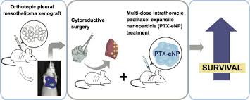 We did not find results for: Paclitaxel Loaded Expansile Nanoparticles Improve Survival Following Cytoreductive Surgery In Pleural Mesothelioma Xenografts Sciencedirect