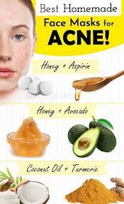 Best Homemade Face Mask For Acne Best Homemade Face Mask Homemade Face Masks Acne Treatment At Home