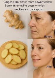 natural remedy for stomach ache, Helicobacter pylori and gastritis