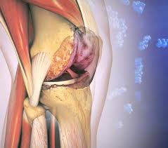 Image result for Knee Joint Injection