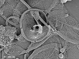 Image result for Raphidiocystis