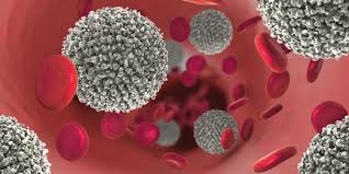 A leucemia nem sempre apresenta sintomas, principalmente na sua apresentação crónica. Leucemia Tratamiento Sintomas E Informacion En Cuidateplus