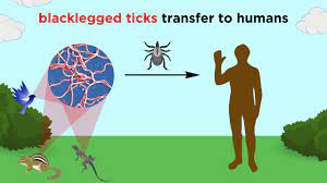 It is not intended to be used for testing patients suspected of acquiring lyme disease outside of the us. Lyme Disease Borrelia Burgdorferi Youtube