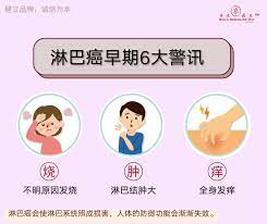 淋巴癌 (malignant lymphoma) 惡性淋巴瘤俗稱淋巴癌，其中包括了兩種疾病，即非何杰金氏淋巴瘤 (nhl non hodgkins lymhpoma)與何杰金氏症 (hd, hodgkins disease)。兩者的差別在於病理型態學的不同以及臨床表現的差異。西方人何杰金氏症較普通，預後比較好，而東方人則非何杰. å¥‡è¿¹å®å…¸ æ·‹å·´ç™Œçš„6å¤§è­¦è®¯ æ·‹å·´ç™Œä¼šç…§æˆæ·‹å·´ç³»ç»ŸæŸå®³ å¥‡è¿¹è¯çŽ‹ ç®­çŒªæž£ è±ªçŒªæž£ æ²³çŒªæž£ Facebook