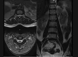 However, that bill can soar contingent upon conditions, area, medical clinic and the specific output that your primary care physician runs. Mri Scan Dubai Radiology Center Same Day Mri