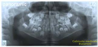 Va anuntam redeschiderea cabinetului din piata mare 2 incepand cu data de luni 17.05.2020. Radiologie Dentara Sector 3 Bucuresti Fm Medident