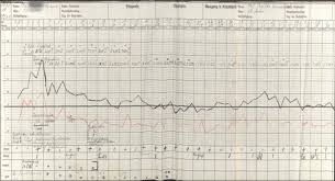 Detail Of The Fever Chart From House 16 Patient Record