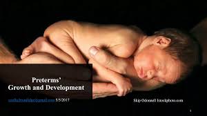 Image result for Preterm Infant Growth