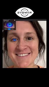 Now Offering Virtual Try-On 👁️✨, 🤩 Which eye is your favorite?!? , We’re  excited to introduce a new way to explore cool custom prosthetic eye  designs! Virtual Try-On! , Choosing a prosthetic eye ...