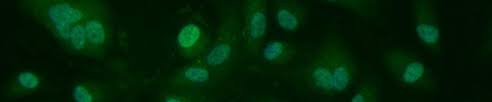 Tion and misidentification is presented. Animal Cells Atcc