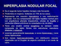 Caracteristicas De La Hiperplasia Nodular Focal Aplicables A La Ecografia Abdominal Caracteristicas De Celulas Conducto