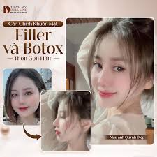 Thẩm Mỹ Doll Line