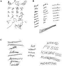 To write in a sprawling, irregular manner.; Agraphia An Overview Sciencedirect Topics