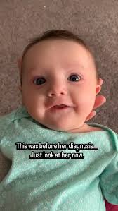 There was so much happening inside Nora’s little body that we couldn’t see  yet., In this first clip she was still undiagnosed., Her body was  struggling in ways we didn’t fully understand., And then… ...