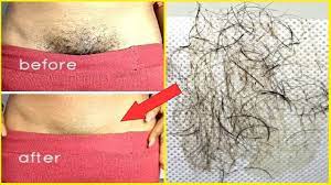 Wet your pubic hair so it's easier to cut. In Just 5 Minutes Remove Pubic Hair Permanently No Shave No Wax Remove Private Part Hair Naturally Youtube