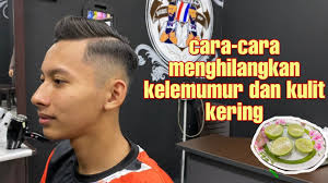 Panduan ini menjelaskan beragam untuk mengusir atau menghilangkan kutu beras, kita dapat menggunakan media sederhana dan. Cara Cara Menghilangkan Kelemumur Kulit Kering Ubat Tradisional Moden Treatment Uppercut Youtube