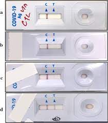 Check spelling or type a new query. Rapid Sars Cov 2 Antigen Detection Assay In Comparison With Real Time Rt Pcr Assay For Laboratory Diagnosis Of Covid 19 In Thailand Virology Journal Full Text