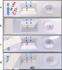 Please follow the instructions provided on your testing receipt. Rapid Sars Cov 2 Antigen Detection Assay In Comparison With Real Time Rt Pcr Assay For Laboratory Diagnosis Of Covid 19 In Thailand Virology Journal Full Text