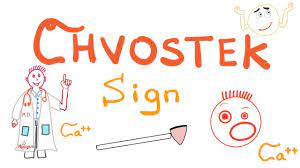 In the late 1800s, dr. Chvostek Sign Tetany Hypocalcemia Clinical Signs Youtube