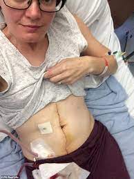 Learn the symptoms of stage iv colon cancer and which tests your doctor uses to find the right treatment. Keen Snowboarder 38 Discovers What She Thought Was A Hernia Is Stage Four Bowel Cancer Daily Mail Online