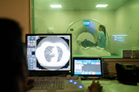 Image result for Prostate Cancer Staging