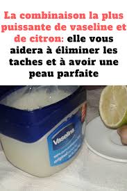 La Combinaison La Plus Puissante De Vaseline Et De Citron Elle Vous Aidera A Eliminer Les Taches Et A Avoir Une Peau Parfaite Combinai Vaseline Rid Education