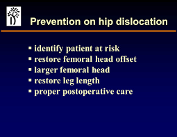 Dislocation after Total Hip Replacement - ppt video online download