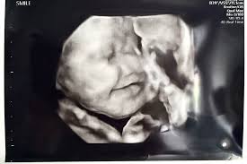 Birth Classes in Edmond, OK