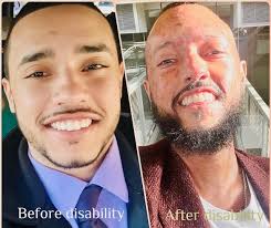 Ebony Wilkinson Joseph, MNPL